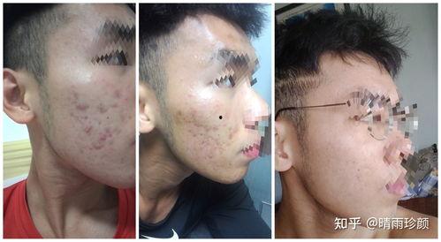 脸上有纹身的网红吃瓜,揭秘娱乐圈背后的秘密 第3张 脸上有纹身的网红吃瓜,揭秘娱乐圈背后的秘密 第3张
